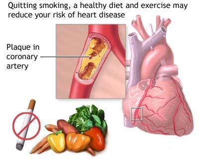 Fumatul si bolile cardiovasculare